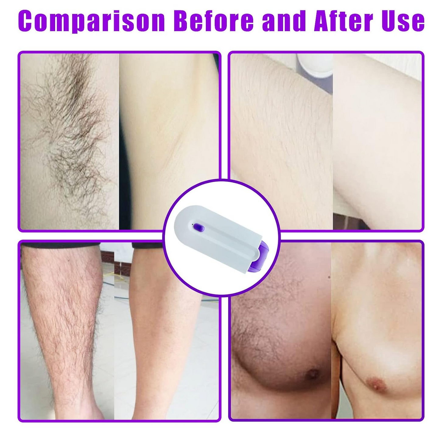 Seurico™ 👩‍⚕️ Purple Light Beauty Photon Silky Painless Hair Removal