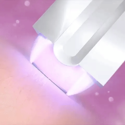 Seurico™ 👩‍⚕️ Purple Light Beauty Photon Silky Painless Hair Removal